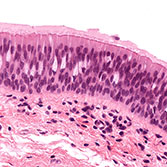 pseudostratified epithelium